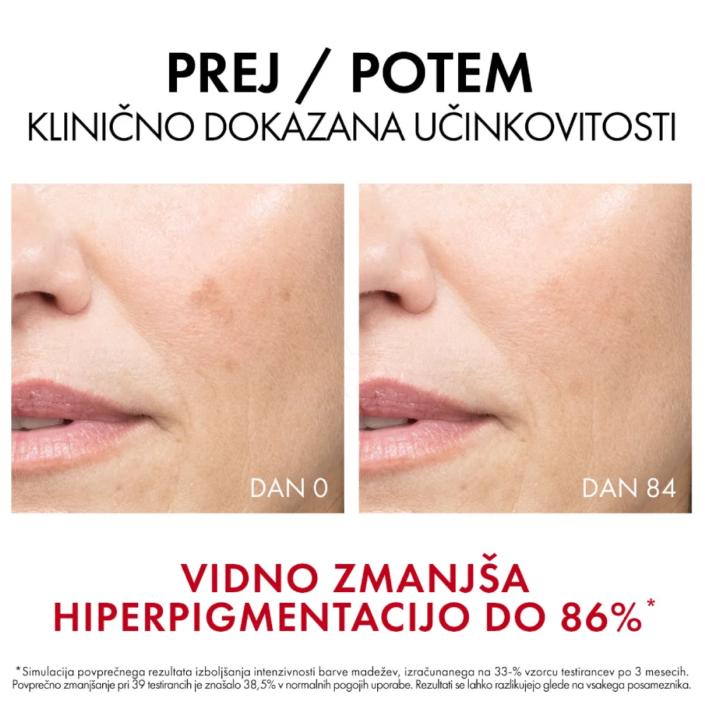 Vichy Liftactiv Specialist B3 Dark Spots, serum proti temnim lisam in gubam za obraz (30 ml)